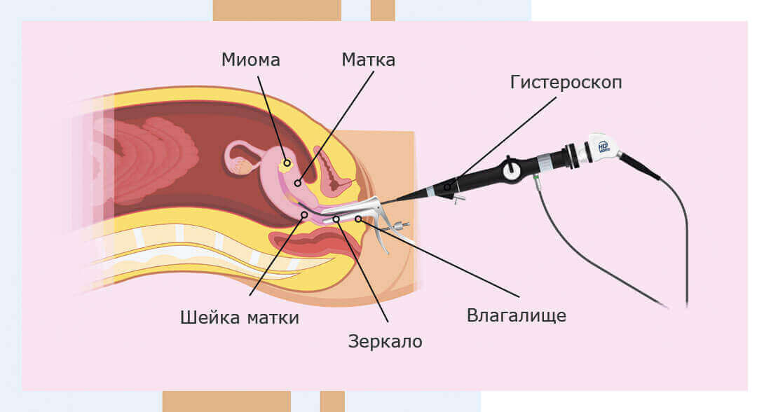 gisterrrra1.jpg